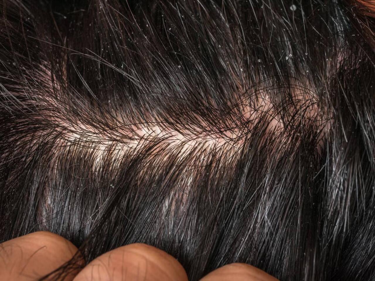 Çox addam ciddiyə almır  Ağır xəstəliklərin əlaməti ola bilər