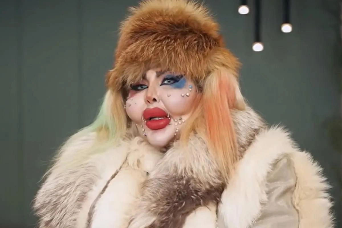 İranlı bloqer estetik əməliyyatlarına g&ouml;rə rekord qırdı