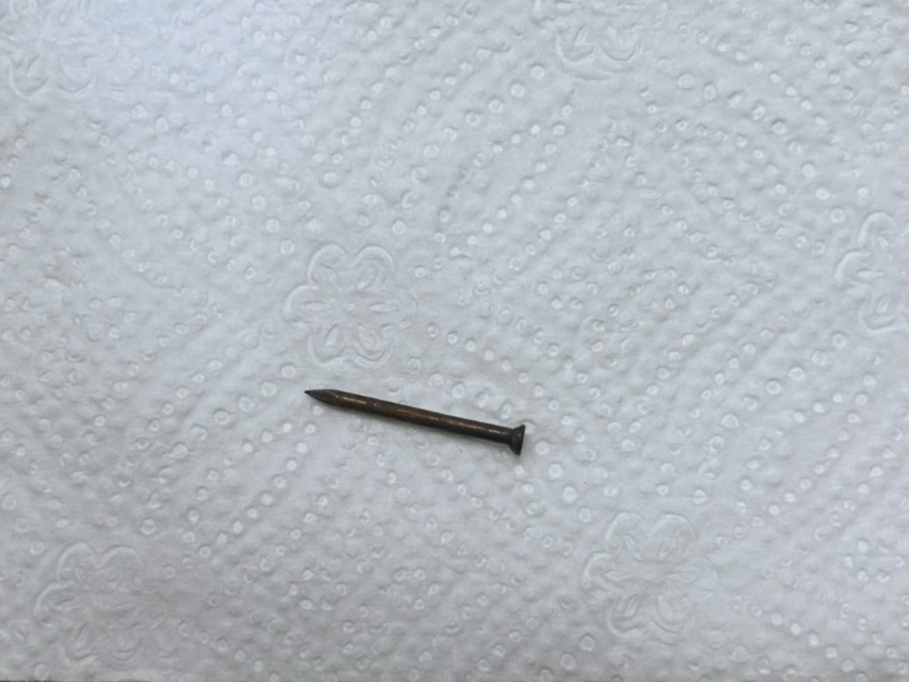 Bakıda azyaşlının mədəsindən mismar &ccedil;ıxarıldı  FOTO