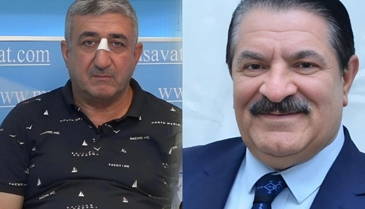 Ağadadaşın balta atdığı mühafizəçi qatarda əxlaqsız hərəkət edibmiş