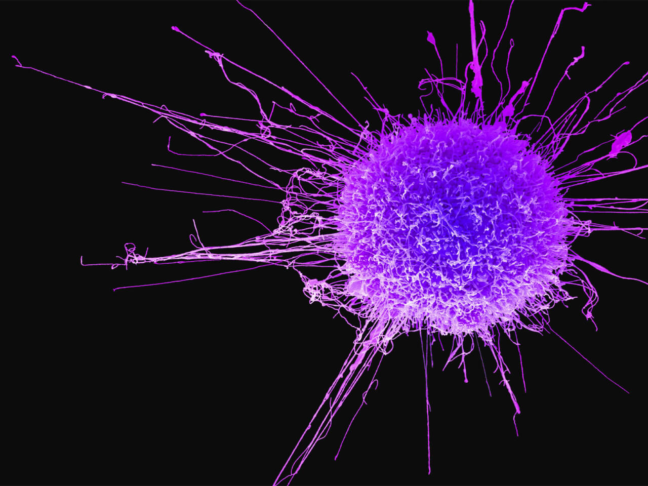 3 həftədən çox davam edən öskürək bu ölümcül xəstəliyin xəbərçisidir