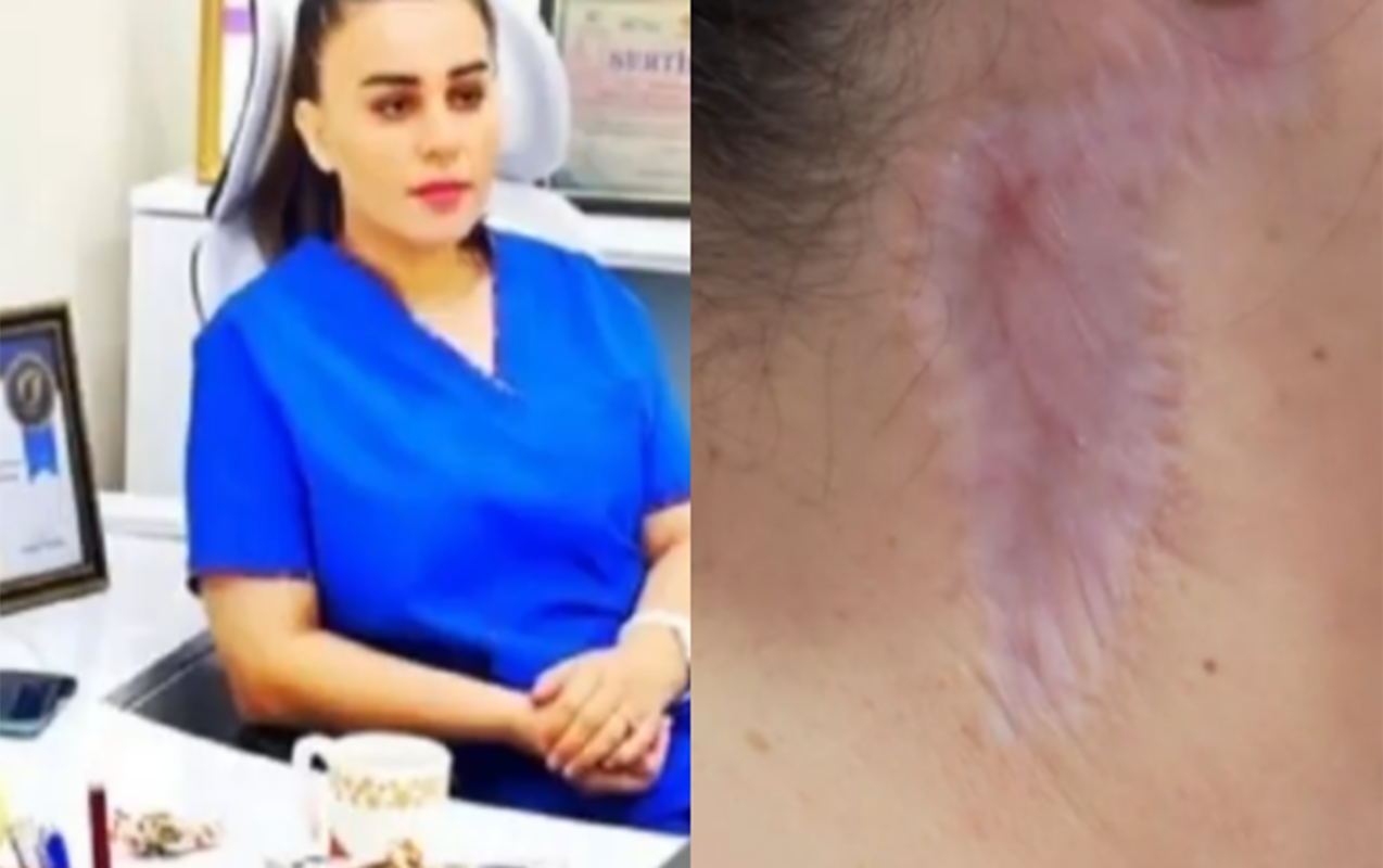 &ldquo;Məni g&ouml;zəllik salonunda əməliyyat etdi, ağzım əyilir&rdquo; 