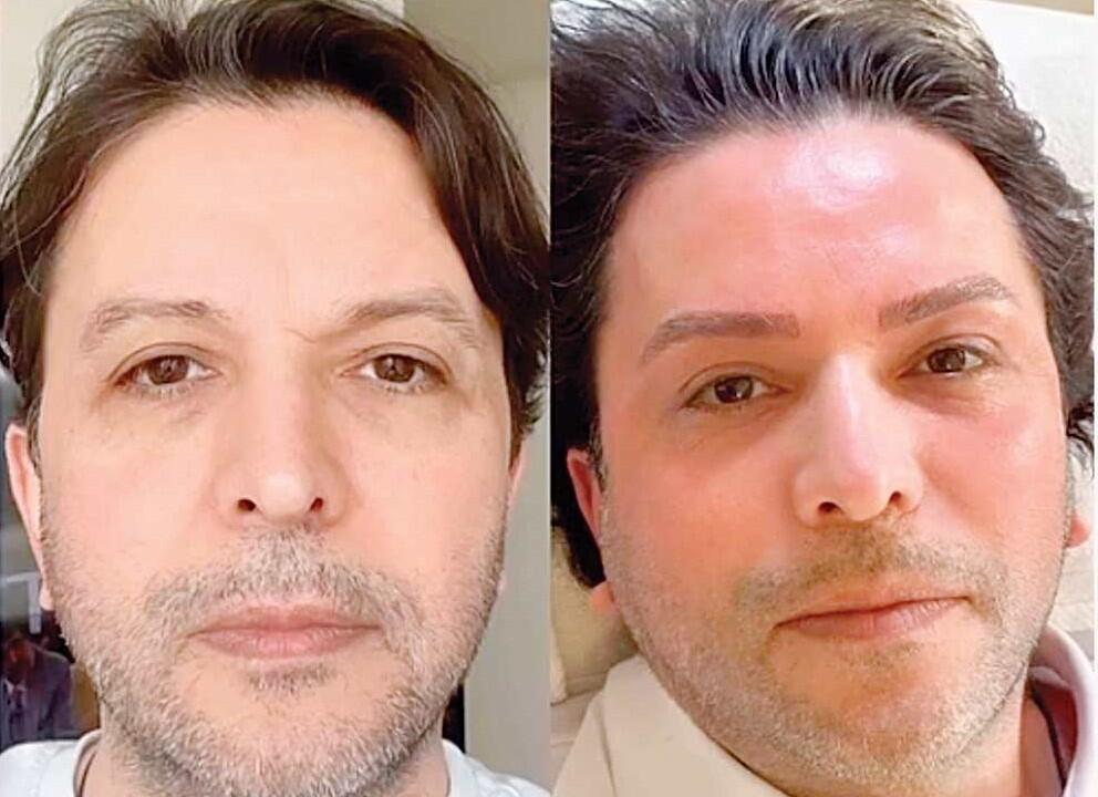 Estetik etdirib özünü tanınmaz hala saldı  FOTO