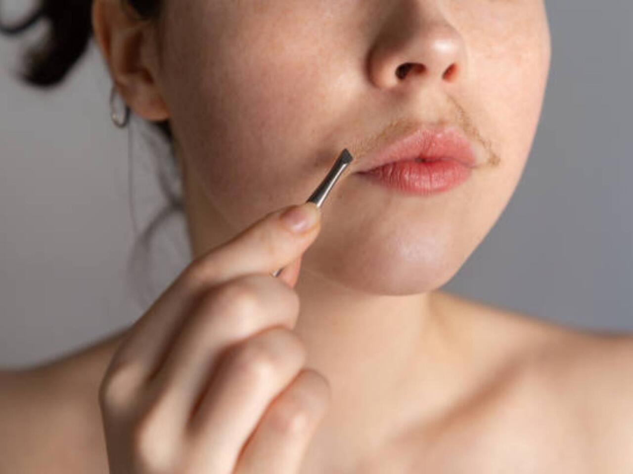 "Qazlı su içən qızlarda "bığ" çıxır"  Həkim