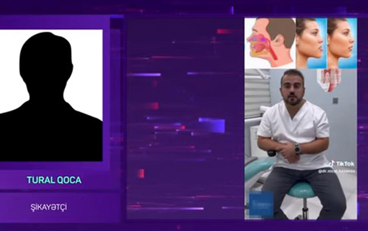 500 manat ziyana düşdü, az qaldı ölsün  “TikTok Stomatoloqu” barəsində AĞIR İDDİA 
