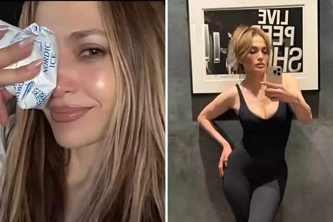 Cennifer məşq zamanı yaralandı  FOTO