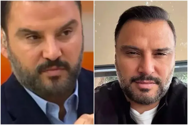 Alişan botoks etdirdiyini belə etiraf etdi 