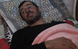 “Ağaclıqdan çıxaraq üstümə gəldi” – Ayının hücumun ediyi Azər 