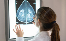 20 yaşdan sonra bunu mütləq edin  Xərçəngin 6 ilkin əlaməti