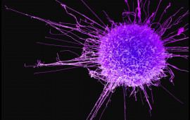 Bu qidalar bağırsaq xərçənginin düşmənidir