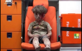 9 il əvvəl hamını məyus etmişdi  İndiki halı diqqət çəkdi  FOTO