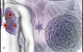 Alimlər ağciyər xərçənginin inkişaf səbəbini tapdı