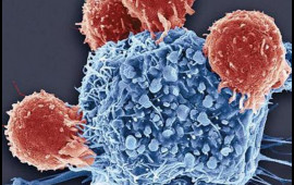 Alimlər xərçəngin ən ölümcül növlərindən birinə səbəb olan vərdişi açıqlayıb