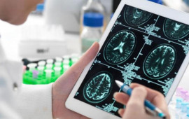 Alzheimerlə mübarizədə yeni ümid