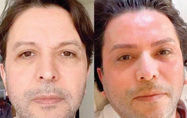 Estetik etdirib özünü tanınmaz hala saldı  FOTO