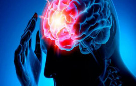 Kasıblar varlılardan daha çox insult keçirirlər  ARAŞDIRMA