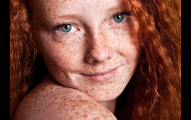 Çilləri belə yox edin