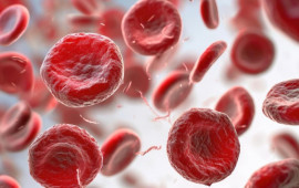 İbrahim Saraçoğlu: Qandakı iltihabı aradan qaldıran 25 günlük təbii resept