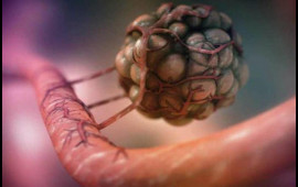 Xər&ccedil;əng m&uuml;alicəsində yeni d&ouml;vr: Kemoterapiyasız tam sağalma