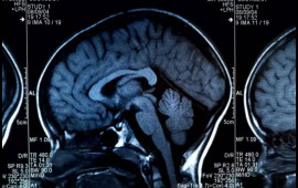 Beyni məhv edən qidalar a&ccedil;ıqlandı  Hər g&uuml;n yeyirik