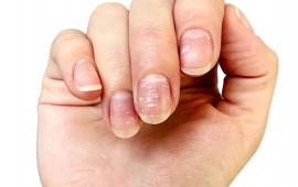 &Ccedil;inko &ccedil;atışmazlığı nələrə səbəb olur  problemi aradan qaldırmağın