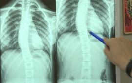 Son zamanlar &ldquo;812&rdquo; yaş arası uşaqlarda bel və boyun ağrılarının səbəbi